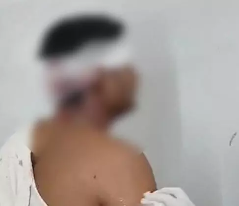 तखतपुर: खेत में पानी डालने जा रहे किसान पर शेर ने किया हमला तखतपुर: खेत में पानी डालने जा रहे किसान पर शेर ने किया हमला