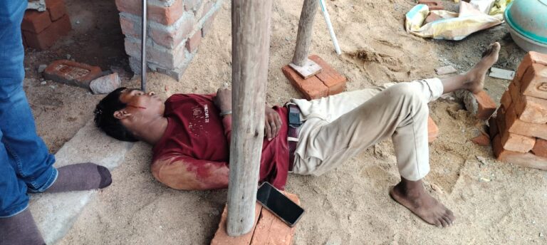 इंदू इमेजिका कालोनी में बड़ा हादसा…हाईटेंशन तार की चपेट में आने से दो मजदूरों की हालत गंभीर…112 ने कराया सिम्स में भर्ती