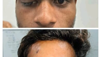 तिरछी आँख को कर दिया सीधा…और सिम्स बना दिया रिकार्ड..