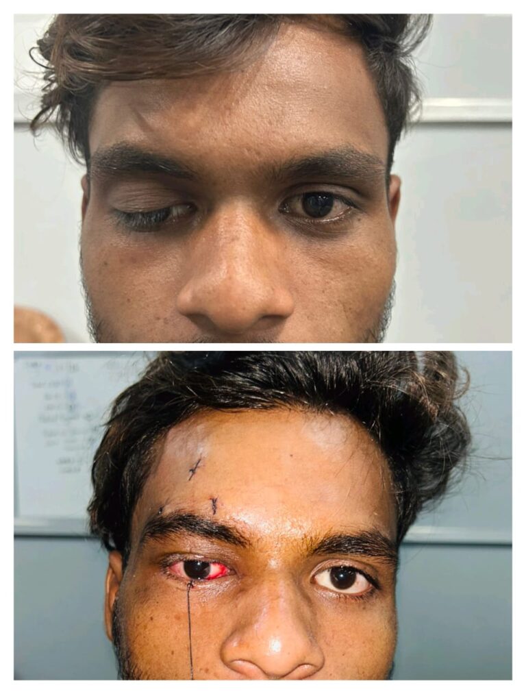 तिरछी आँख को कर दिया सीधा…और सिम्स बना दिया रिकार्ड..