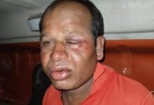 मंत्री के भतीजे पर बर्बर मारपीट का आरोप, पुलिस पर दबाव बनाने पर हड़कंप..पीड़ित की हालत गंभीर