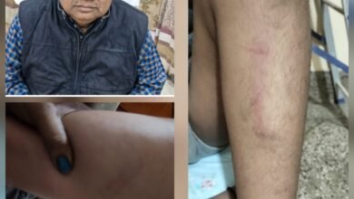 तखतपुर में मासूमों पर पाइप का कहर! स्पोर्ट्स टीचर की हैवानियत, स्कूल प्रबंधन ने कहा—जो करना है कर लो.. जिला शिक्षा अधिकारी ने कही यह बात