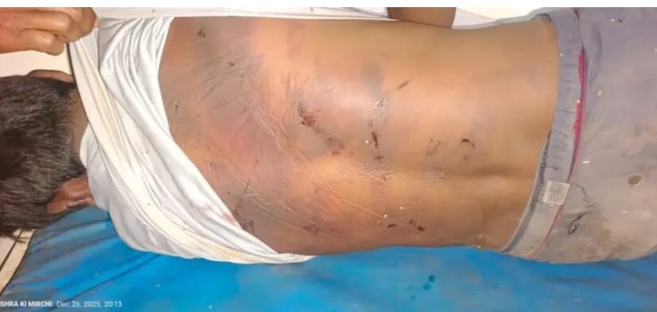 अपहरण के बाद मौत का तांडव: घर के दरवाज़े पर फेंकी गई लाश.. लाचार सिस्टम देखता रह गया