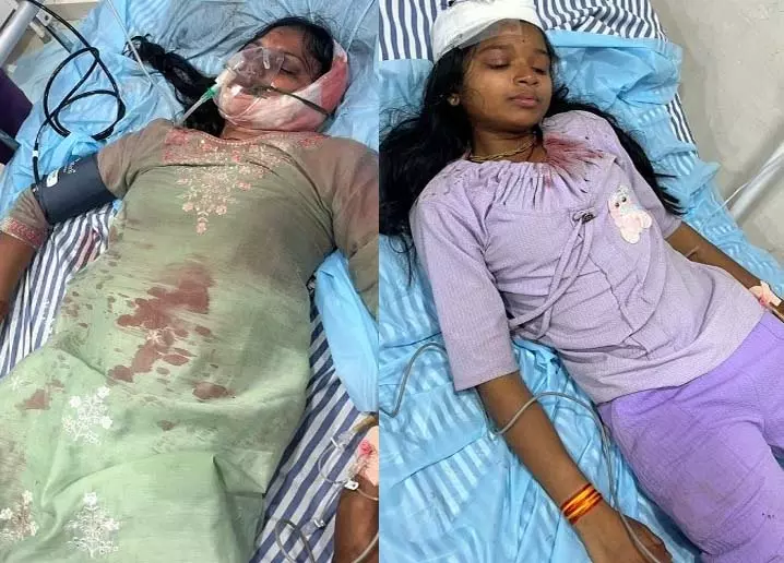 लापरवाही का लाइसेंस: निगम-पंचायत की आंखों के सामने गिरा आकाश झूला, एक युवती जिंदगी-मौत के बीच