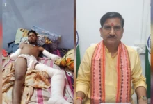 33 केवी करंट ने उजाड़ा जीवन — दोनों हाथ कटे, अब पैर पर खतरा; जनदर्शन में फूटा दर्द, तोखन साहू का सीधा एक्शन, भारती ने थामी न्याय की कमान