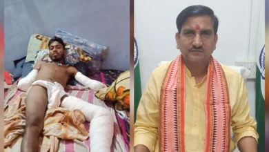 33 केवी करंट ने उजाड़ा जीवन — दोनों हाथ कटे, अब पैर पर खतरा; जनदर्शन में फूटा दर्द, तोखन साहू का सीधा एक्शन, भारती ने थामी न्याय की कमान