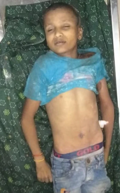 अचानक बदला मौसम, गिरा कहर: आकाशीय बिजली से चपेट में आया बच्चा..दीपक की मौत