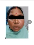निजी अस्पतालों में महंगा इलाज नहीं करा सकी महिला, सिम्स ने संभाला मोर्चा; जबड़े की बड़ी सिस्ट का सफल इलाज