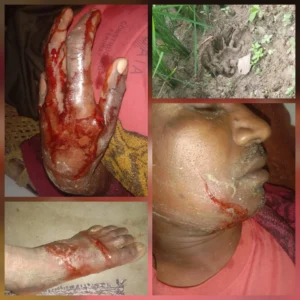खेत में अचानक बाघ का हमला, किसान ने तसले से लड़ी जिंदगी की लड़ाई